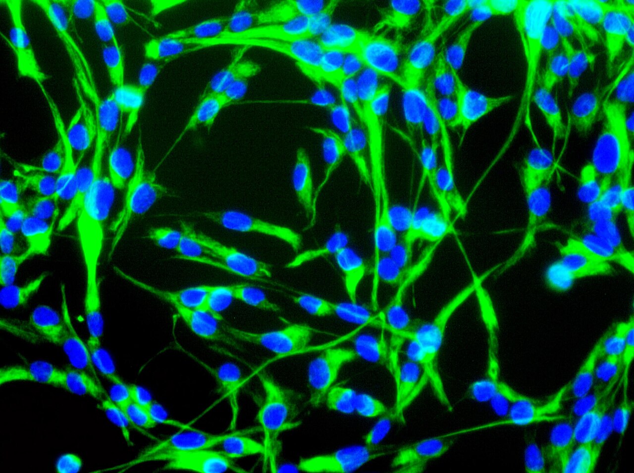 Mouse neural stem cells growing in culture. Neural stem cells can be made to develop into cells found in the central nervous system; neurons, astrocytes and oligodendrocytes.