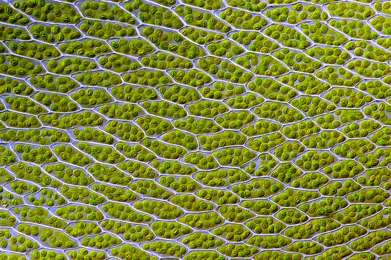 Live leaf cells of the moss Bryum capillare , showing abundant chloroplasts (green spherical bodies) and their accumulated starch granules (elongated bodies within chloroplasts).