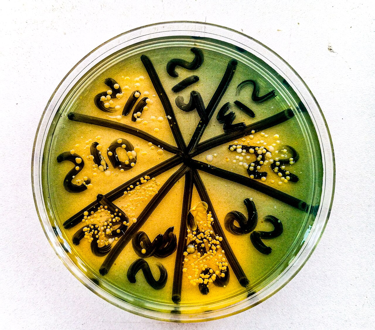 The petri dish is partitioned with black marker to differentiate that of one patient from another, using their identification numbers as seen in the photograph.