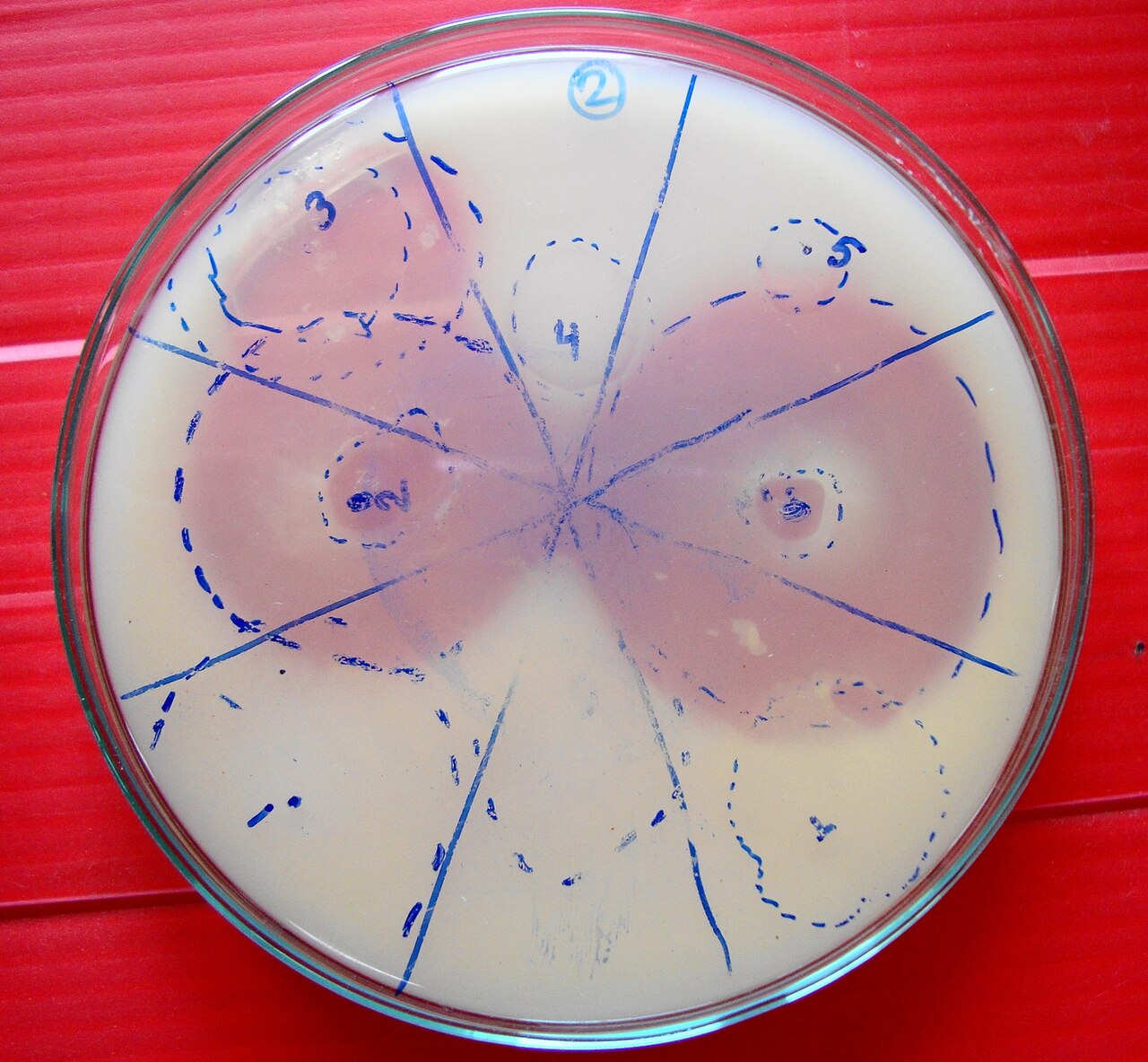 Phosphate solubilizing bacteria cultured in petri dish containing specific media for growth. Image shows phosphate solubilizing bacteria utilizes the media for their growth. The zone of clearance can be clearly seen in the image.
