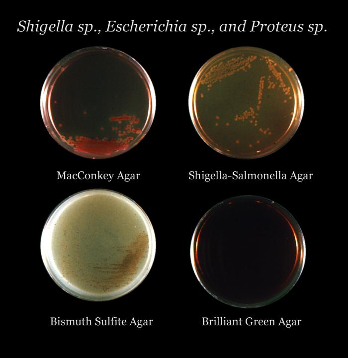 Your Scalp Has a Microbiome. It Might Be Contributing to Your Hair Loss.