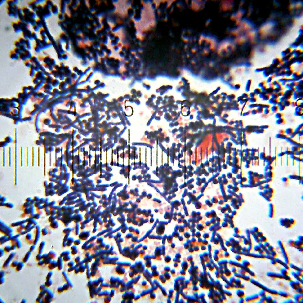 These bacteria were cultured from a urine sample from a woman who thought she had a urinary tract infection . I'm definitely not seeing any Escherichia Coli in this sample, which is supposedly the most common agent by far in such infections