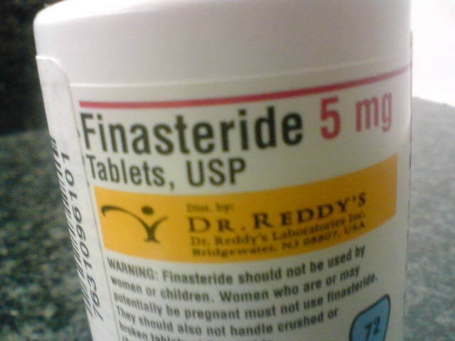 finasteride