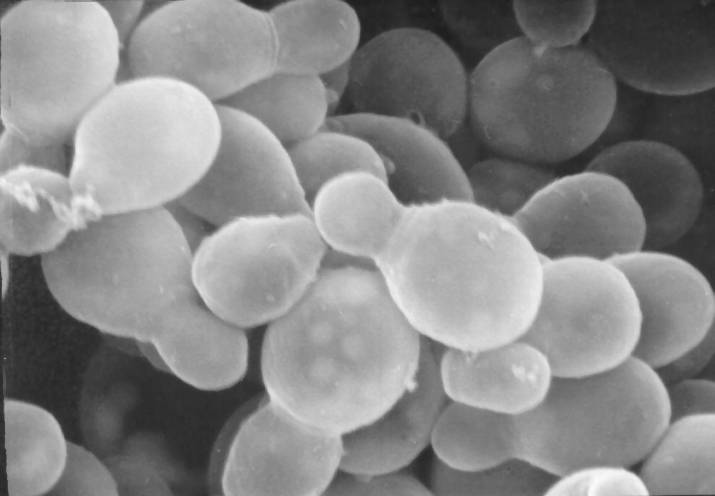 ID#: 213 Description: Scanning Electron Micrograph of Malassezia furfur Content Providers(s): Robert Simmons/Janice Carr Photo Credit: CDC/Janice Carr Copyright Restrictions: None - This image is in the public domain and thus free of any co