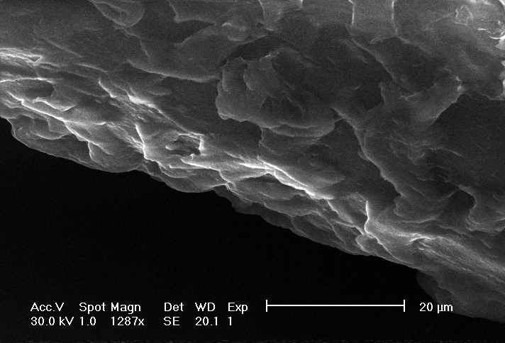 Picture of a human hair, taken with a scanning electron microscope. Mode: secondary electrons
