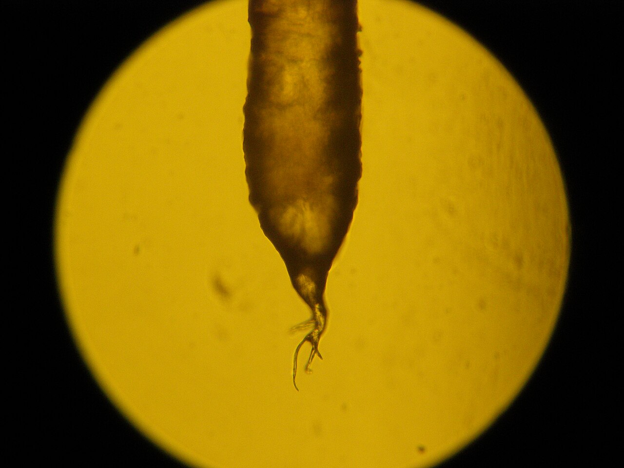 A human black hair root in light microscope.