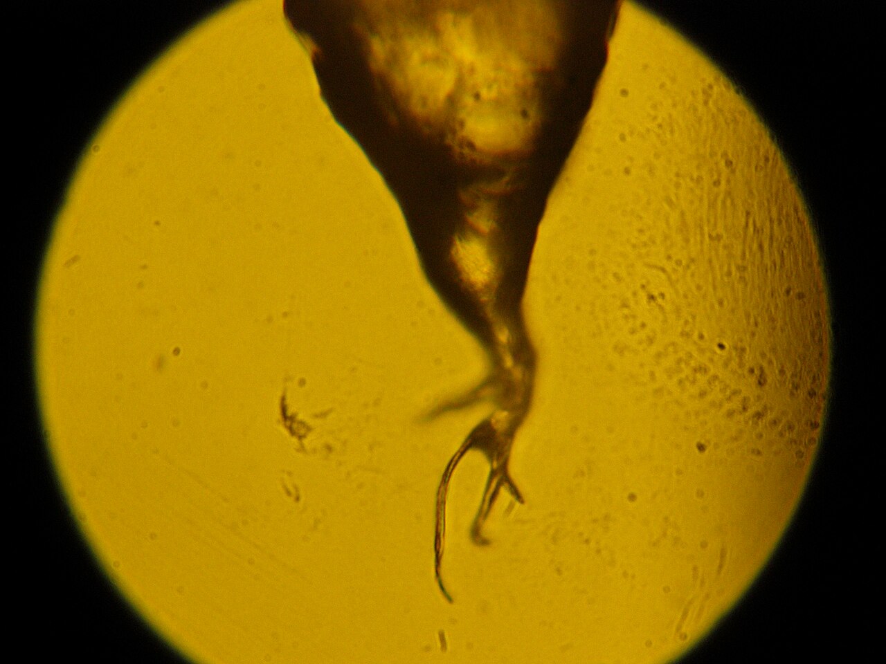 A human black hair root in light microscope.